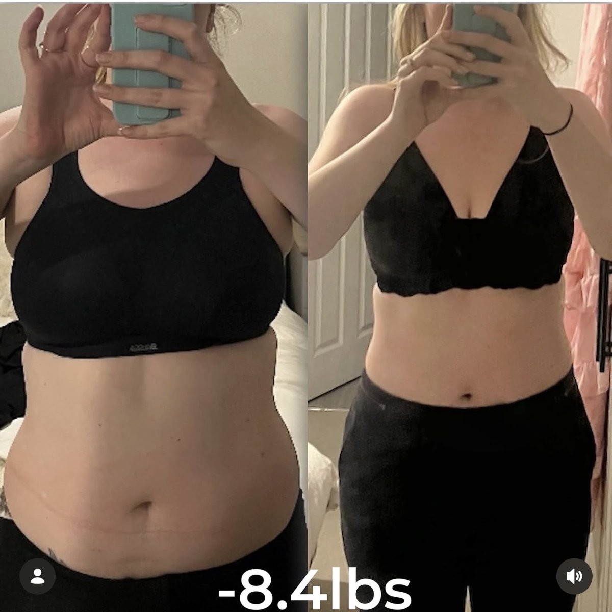Bite Back client before and after progress photo 3
