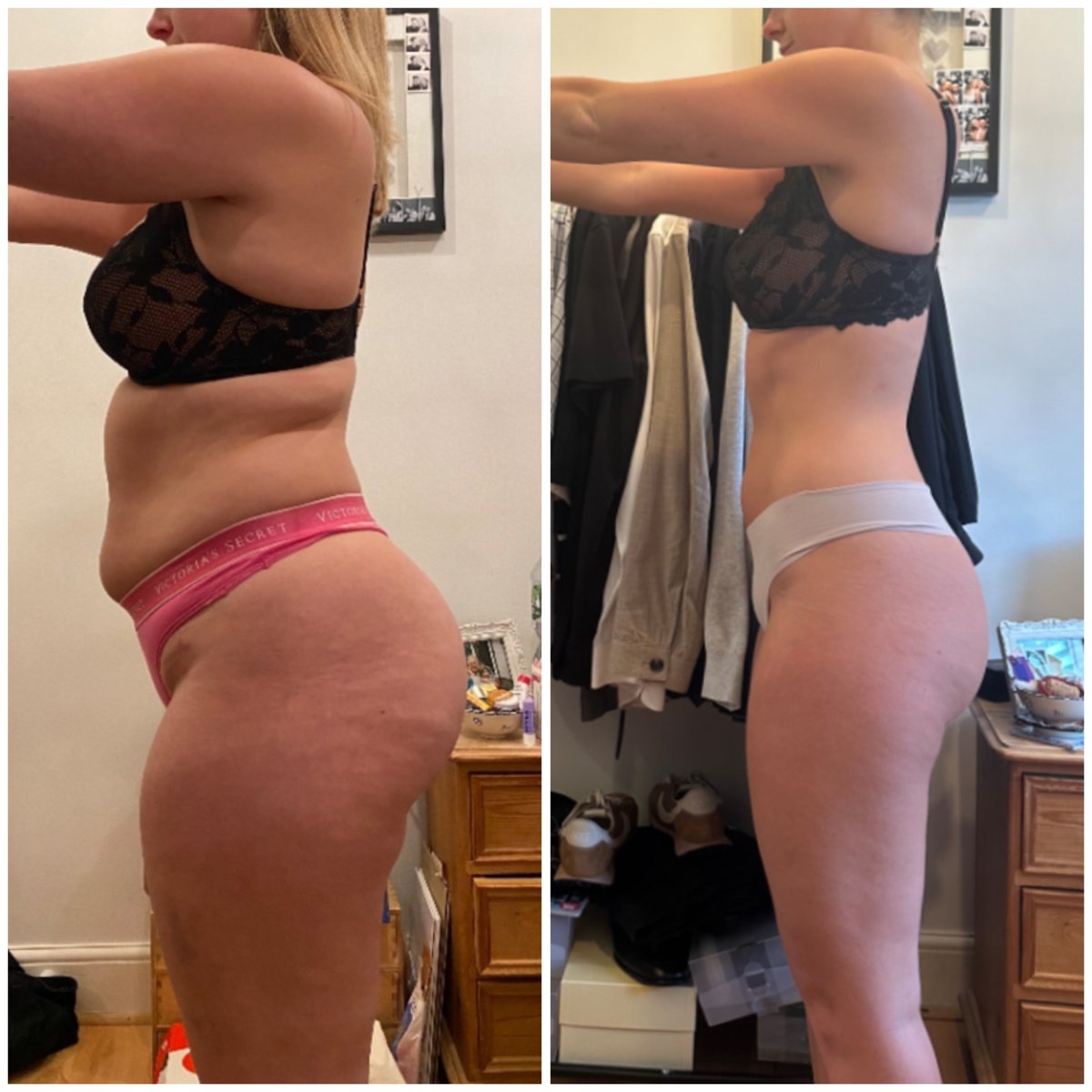 Bite Back client before and after progress photo 1